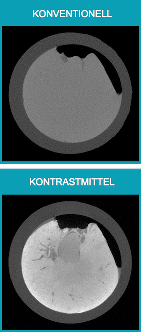 Roentgen Mikro CT Gewebe mit Kontrastmittel