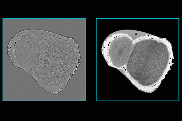 Dual energy micro CT for improved material characterization in X-ray imaging