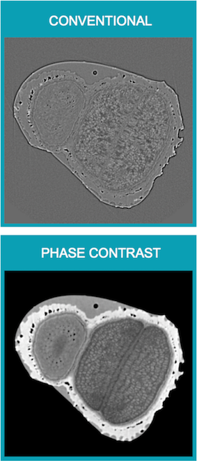 Enhancing micro computed tomography imaging with phase contrast