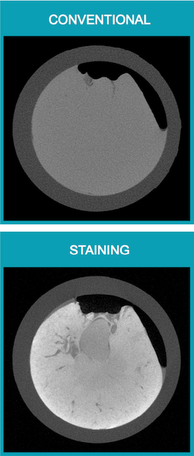 X-ray contrast agents for micro ct analysis of tissues