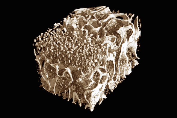 3D visualization of bone struction with X-ray micro computed tomography