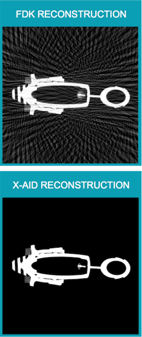 Improved CT reconstruction by XAID for undersampling in industrial computed tomography